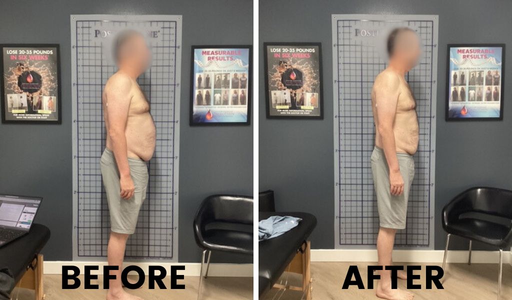 Home | lakeside spine and wellness | chiropractor renton wa